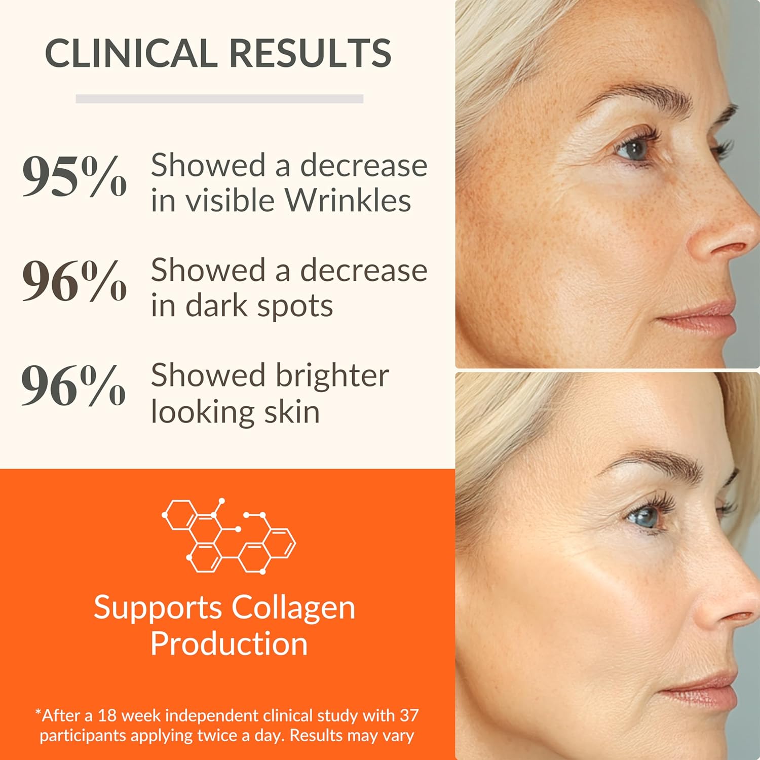 81w2-5MMjgL._SL1500_