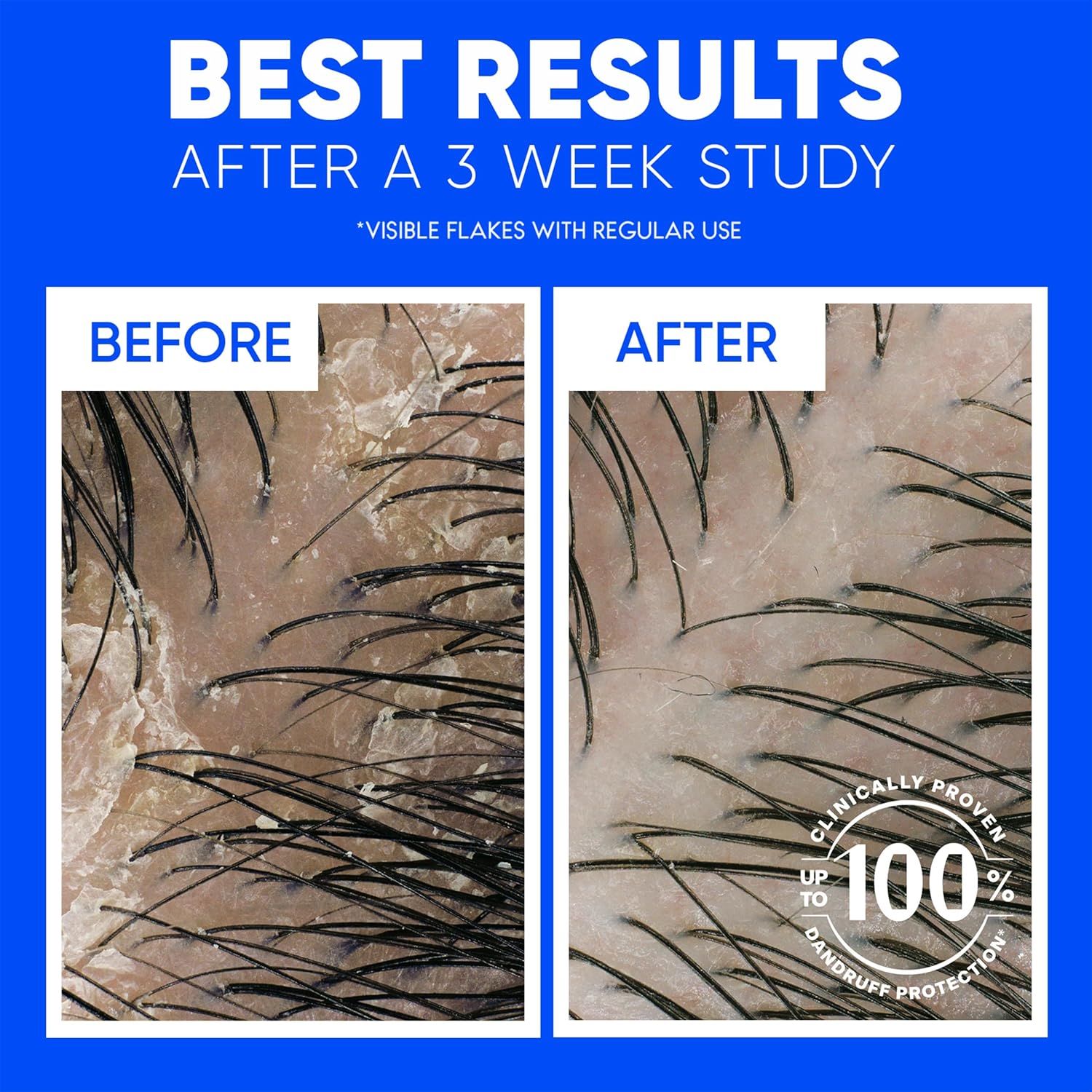 91fYDdEF1VL._SL1500_